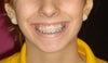 my uneven smile.