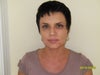 After treatment with Radiesse