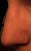 taken from left