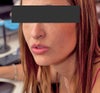 my chin a few years ago did not look quite as bulbus.... Although this is the most flattering angle for my face. :/