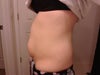 Left side