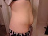 Right side