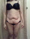 Pre June Surgery