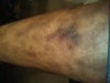 This is a picture of my leg just below knee