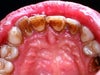 i just want clearer and whiter teeth