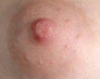 normal state which i want to avoid by using silicon injection.