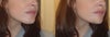3/4 side of my face that look weird to me and what seems better after