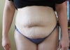 Stomach muscles fully relaxed