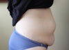 Stomach muscles fully relaxed