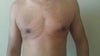 chest view # 1