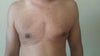 Chest View # 2