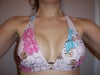 Post-op - 7 months w/bathing suit (note bulge on right breast, too close to center)