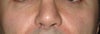 close up
