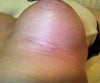 left breast underneath