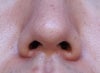 Nose slightly upturned