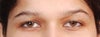 Eyes