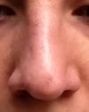Frontal