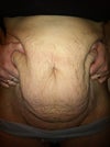 A bunch of skin