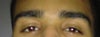 look at my eyes! what can b done?