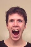 My moth opens crooked and clicks on the LFT. W.more LFT jaw, I feel it will be more straight.
