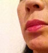 RIght cheek looks good and has definition