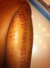 Four days after treatment.