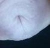 front belly