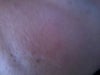 right cheek