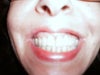 another pic of my smile