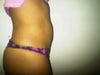 Side