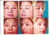 Before and After Comparison