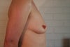 Story I sent PS:  http://www.realself.com/review/Breast-implants-4-Months-Post-Want-to-look-natural