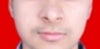 assymentric cheeks