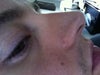 my right side