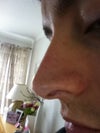 my left side - hanging columella