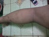 my scars in my legs.