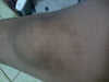 my scar's color is brown