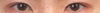 my current eyes