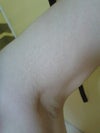 upper arm again