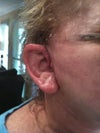 ears pt 2