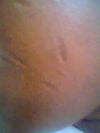 D left side of my face