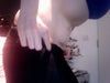 Loose skin on stomach