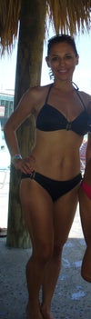 This is me before surgery