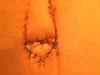 belly button