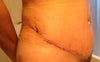 bikini cut - beyond anyone's expectations