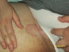 inside of thigh in groin area