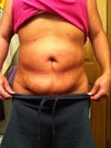this came on 2 weeks ago and Doctor said it was fluid and i will get this for a year