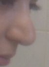 1000 worse than before I had surgery