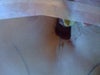 Blood escaping from belly button over and over until I went into surgey. Could not get it to stop.