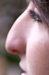 profile before surgery